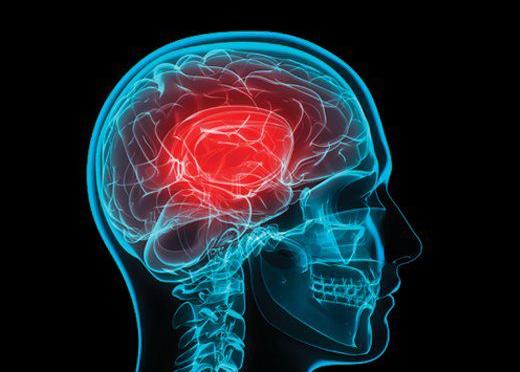 Concussion (Image)